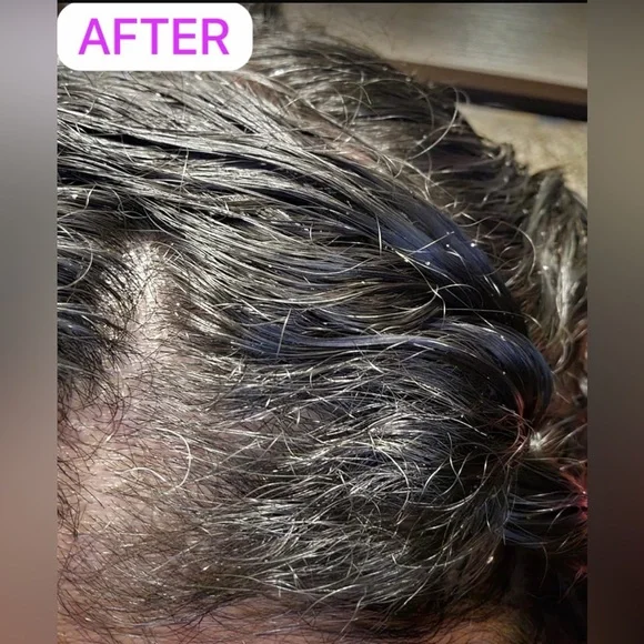 Nizoral Anti-Dandruff Shampoo - Picture 3 of 4